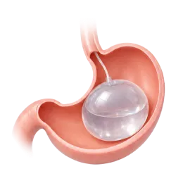 stomach 1